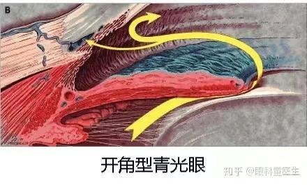 5 5